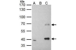 IP Image MSL3L1 antibody immunoprecipitates MSL3L1 protein in IP experiments. (MSL3 anticorps  (Center))
