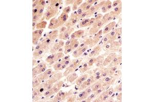 (ABIN6243360 and ABIN6577092) staining FER in human liver tissue sections by Immunohistochemistry (IHC-P - paraformaldehyde-fixed, paraffin-embedded sections). (FER anticorps  (AA 1-300))
