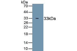 Detection of Recombinant MYH4, Human using Monoclonal Antibody to Myosin Heavy Chain 4, Skeletal Muscle (MYH4)