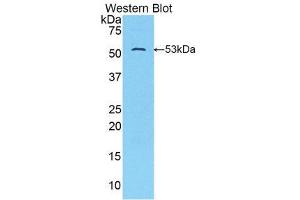 Western Blotting (WB) image for anti-Solute Carrier Family 2 (Facilitated Glucose Transporter), Member 14 (SLC2A14) (AA 51-105) antibody (ABIN1859032)