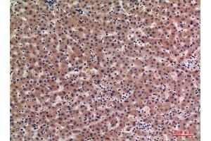 Immunohistochemistry (IHC) analysis of paraffin-embedded Human Liver, antibody was diluted at 1:100. (IGFBPI anticorps  (Internal Region))