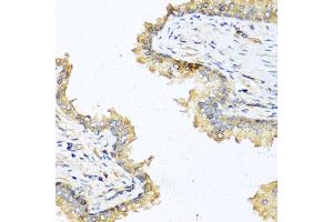 Immunohistochemistry of paraffin-embedded human prostate using DEFB121 antibody (ABIN5970550) at dilution of 1/100 (40x lens).