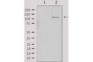 Western blot analysis of extracts from Hela, using MBTPS1 Antibody. (MBTPS1 anticorps  (Internal Region))