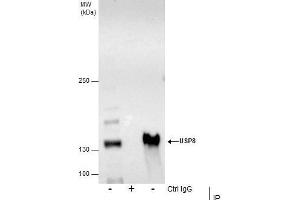 IP Image Immunoprecipitation of USP8 protein from HCT-116 whole cell extracts using 5 μg of USP8 antibody, Western blot analysis was performed using USP8 antibody, EasyBlot anti-Rabbit IgG  was used as a secondary reagent. (USP8 anticorps)