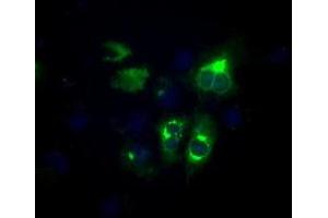 Image no. 2 for anti-Lipase, Endothelial (LIPG) antibody (ABIN1499165) (LIPG anticorps)
