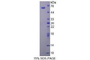 SDS-PAGE (SDS) image for Aldehyde Dehydrogenase 1 Family, Member A1 (ALDH1A1) (AA 2-501) protein (His tag) (ABIN4990313) (ALDH1A1 Protein (AA 2-501) (His tag))
