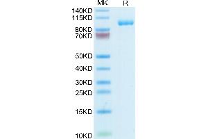 Human TPO/Thyroid Peroxidase on Tris-Bis PAGE under reduced condition.
