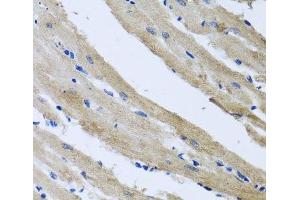 Immunohistochemistry of paraffin-embedded Rat heart using ST8SIA2 Polyclonal Antibody at dilution of 1:100 (40x lens). (ST8SIA2 anticorps)
