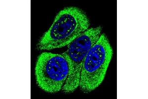 Confocal immunofluorescent analysis of Phospho-ABL1- Antibody (ABIN6241067 and ABIN6578924) with MCF-7 cell followed by Alexa Fluor 488-conjugated goat anti-rabbit lgG (green).
