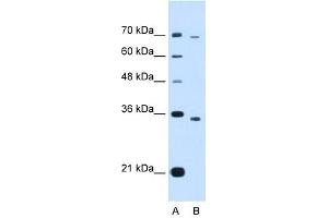 PHF6 antibody (20R-1278) used at 0. (PHF6 anticorps  (Middle Region))
