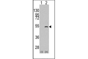 Image no. 1 for anti-Elongator complex protein 3 (ELP3) (C-Term) antibody (ABIN356662)
