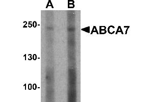 Western blot analysis of ABCA7 in 293 cell lysate with ABCA7 antibody at (A) 1 and (B) 2 µg/mL. (ABCA7 anticorps  (N-Term))