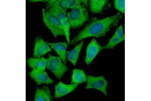 Immunofluorescence of human HeLa cells stained with Hoechst 33342 (Blue) and monoclonal anti-Hexokinase antibody (1:1000) with Alexa 488 (Green).