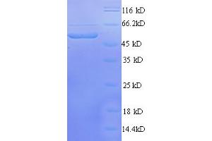 SDS-PAGE (SDS) image for Transcriptional Adaptor 3 (TADA3) (AA 1-238), (partial) protein (GST tag) (ABIN5712301) (TADA3L Protein (AA 1-238, partial) (GST tag))