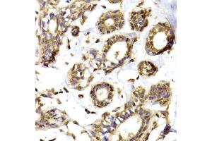 Immunohistochemistry of paraffin-embedded human breast using RPL13 Antibody (ABIN5974062) at dilution of 1/100 (40x lens).