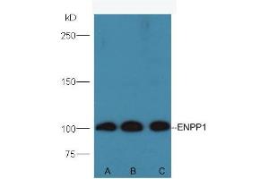 Lane A: Mouse testis lysates Lane B: Mouse kidney lysates Lane C: Mouse pancreas lysates. (ENPP1 anticorps  (AA 41-140))