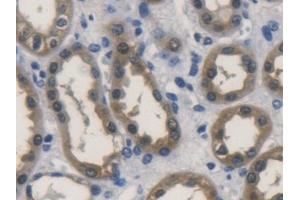 Detection of ALDH1A1 in Human Kidney Tissue using Polyclonal Antibody to Aldehyde Dehydrogenase 1 Family, Member A1 (ALDH1A1)