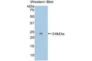 Western Blotting (WB) image for anti-Intercellular Adhesion Molecule 4 (ICAM4) (AA 52-234) antibody (ABIN1859245)