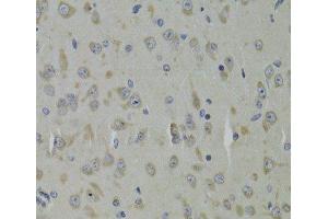 Immunohistochemistry of paraffin-embedded Mouse brain using RPL9 Polyclonal Antibody at dilution of 1:100 (40x lens).