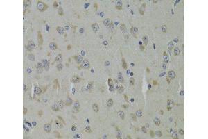 Immunohistochemistry of paraffin-embedded Mouse brain using RPL9 Polyclonal Antibody at dilution of 1:100 (40x lens). (RPL9 anticorps)