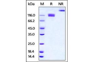 Mouse M-CSF R, Fc Tag, low endotoxin on SDS-PAGE under reducing (R) and no-reducing (NR) conditions. (CSF1R Protein (AA 20-511) (Fc Tag))
