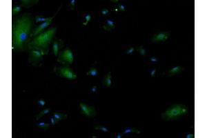 PFA fixed A549 cells with Anti-TTF1 Polyclonal Antibody  at 1:200 dilution, followed by conjugation to the secondary, Goat Anti-Rabbit IgG A488 1:100 for 30min.