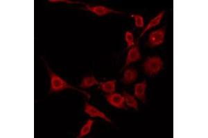 ABIN6275345 staining A549 by IF/ICC. (EHHADH anticorps  (Internal Region))