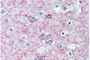 Human Brain, Putamen (formalin-fixed, paraffin-embedded) stained with ADORA2A antibody ABIN305729 at 5 ug/ml followed by biotinylated anti-mouse IgG secondary antibody ABIN481714, alkaline phosphatase-streptavidin and chromogen.