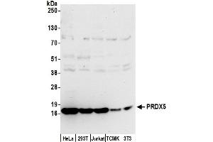 Western Blotting (WB) image for anti-Peroxiredoxin 5 (PRDX5) (AA 164-214) antibody (ABIN7450598)