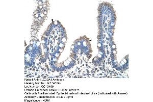 Rabbit Anti-SLC22A1 Antibody  Paraffin Embedded Tissue: Human Intestine Cellular Data: Epithelial cells of intestinal villas Antibody Concentration: 4.