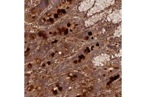 Immunohistochemical staining of human duodenum with LRRC38 polyclonal antibody  shows strong cytoplasmic positivity in glandular cells. (LRRC38 anticorps)