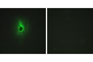 Peptide - +Immunohistochemistry analysis of paraffin-embedded human breast carcinoma tissue using Collagen VI α3 antibody. (COL6a3 anticorps)
