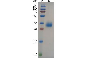 SARS-CoV-2 RBD(L452R,T478K) Protein, His Tag on SDS-PAGE under reducing condition.