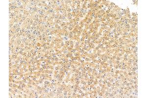 ABIN7094866 and ABIN7098918 at 1/100 staining Rat liver tissue by IHC-P.