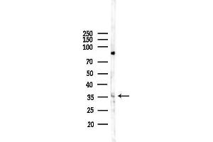 Western blot analysis of lysates from F10-LUC cells(heat-shock,45 min treatment), using OR2C1 Antibody at 1/1000 dilution.