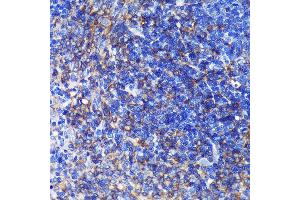 Immunohistochemistry of paraffin-embedded Rat spleen using SW Rabbit pAb (ABIN7270654) at dilution of 1:100 (40x lens).