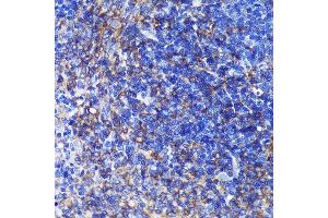 Immunohistochemistry of paraffin-embedded Rat spleen using SW Rabbit pAb (ABIN7270654) at dilution of 1:100 (40x lens). (SWAP70 anticorps  (AA 316-585))