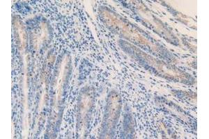 IHC-P analysis of Mouse Intestine Tissue, with DAB staining. (MGST1 anticorps  (AA 8-155))
