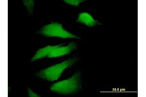 Immunofluorescence of monoclonal antibody to EDIL3 on HeLa cell.