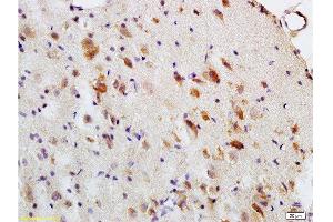 Formalin-fixed and paraffin embedded: rat brain tissue labeled with Anti-MBP Polyclonal Antibody , Unconjugated at 1:200, followed by conjugation to the secondary antibody and DAB staining (MBP anticorps  (AA 69-85))