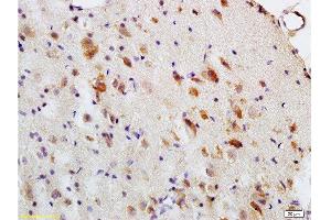 Formalin-fixed and paraffin embedded: rat brain tissue labeled with Anti-MBP Polyclonal Antibody , Unconjugated at 1:200, followed by conjugation to the secondary antibody and DAB staining (MBP anticorps  (AA 69-85))