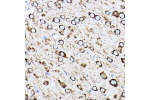 Immunohistochemistry of paraffin-embedded mouse brain using RPL17 Rabbit pAb (ABIN6128342, ABIN6147115, ABIN6147116 and ABIN6221632) at dilution of 1:100 (40x lens). (RPL17 anticorps  (AA 1-184))