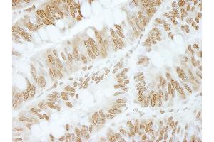 Immunohistochemistry (IHC) image for anti-Zinc Finger and BTB Domain Containing 40 (ZBTB40) (AA 1140-1190) antibody (ABIN7448873)