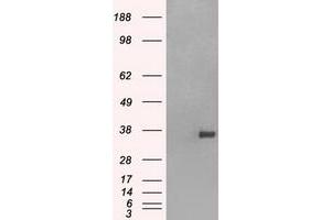 Image no. 9 for anti-Fc Fragment of IgG, Low Affinity IIa, Receptor (CD32) (FCGR2A) antibody (ABIN1497259)
