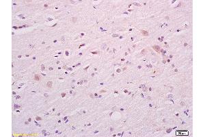 Formalin-fixed and paraffin embedded rat brain tissue labeled with Anti CKAP4 Polyclonal Antibody,Unconjugated (ABIN717506) at 1:200 followed by conjugation to the secondary antibody and DAB staining. (CKAP4 anticorps  (AA 525-602))