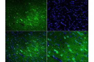 Formalin-fixed and paraffin embedded rat brain labeled with Rabbit Anti-Talin Polyclonal Antibody, FITC Conjugated at 1:200 for 60 minutes. (TLN1 anticorps  (AA 1601-1750) (FITC))