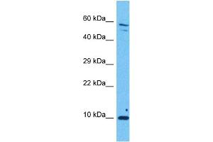 Host:  Rabbit  Target Name:  DBI  Sample Tissue:  Human Ovary Tumor  Antibody Dilution:  1ug/ml (Diazepam Binding Inhibitor anticorps  (N-Term))