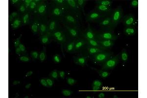 Immunofluorescence of monoclonal antibody to FAF1 on HeLa cell.