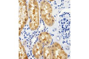 Immunohistochemical analysis of paraffin-embedded H.