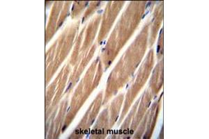 PIP5KL1 Antibody immunohistochemistry analysis in formalin fixed and paraffin embedded human skeletal muscle followed by peroxidase conjugation of the secondary antibody and DAB staining. (PIP5KL1 anticorps  (N-Term))